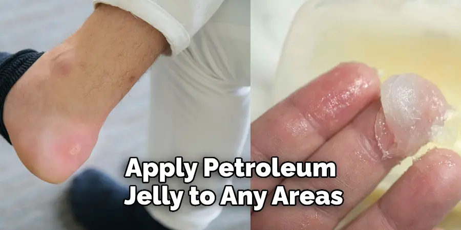 Apply Petroleum Jelly to Any Areas