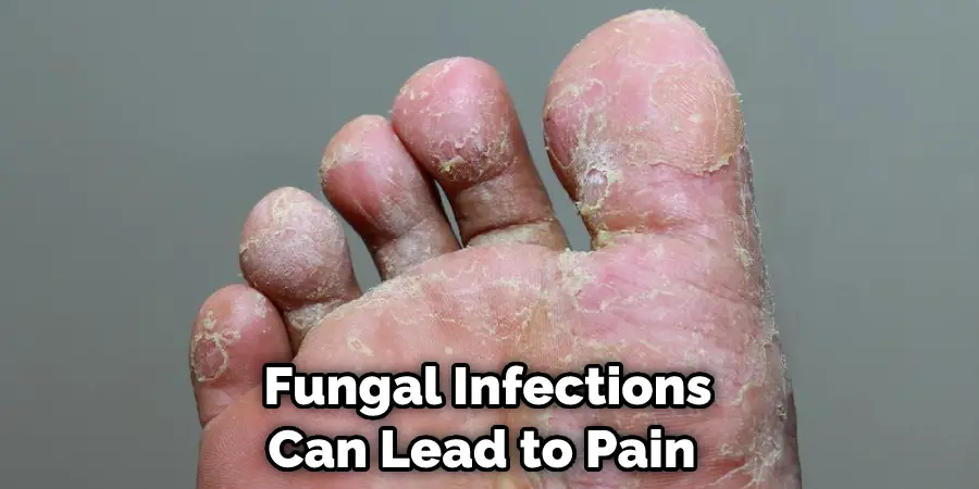  Fungal Infections Can Lead to Pain