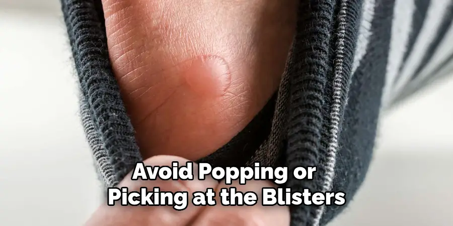 Avoid Popping or Picking at the Blisters