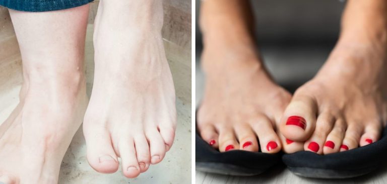 why-do-my-feet-smell-like-vinegar-15-effective-ways